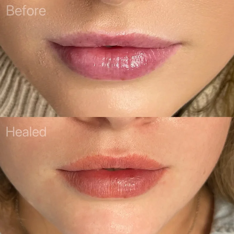 Lip Blush Aftercare: How to Care for Your Lip Blush Tattoo?