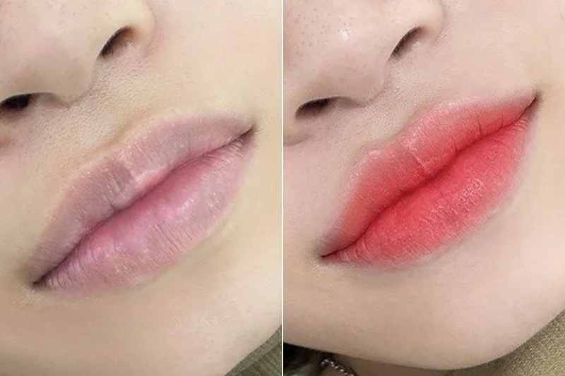 Improved Lip Color and Definition