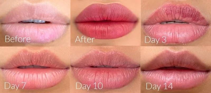 Basic Lip Blushing Aftercare