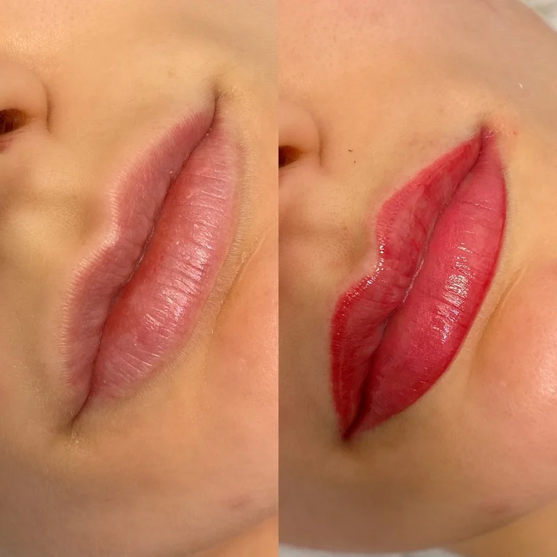 Factors Affecting Is Lip Blushing